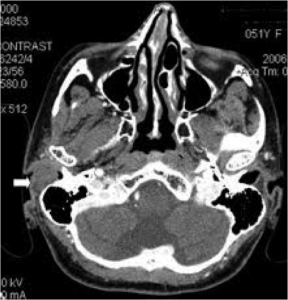 This is a CT image of the head