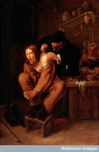 L0027284 A surgeon applying medicine to a wound in the shoulder of a Credit: Wellcome Library, London. Wellcome Images images@wellcome.ac.uk http://wellcomeimages.org A surgeon applying medicine to a wound in the shoulder of a man in pain. Oil painting by Gerrit Lundens, 1649. Oil 1649 By: Gerrit LundensPublished: 1649 Copyrighted work available under Creative Commons Attribution only licence CC BY 4.0 http://creativecommons.org/licenses/by/4.0/