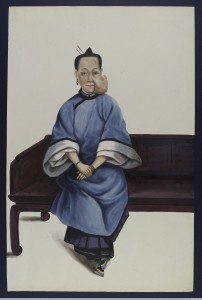 L0037319 Credit: Wellcome Library, London A Chinese lady (Lo Wanshun) from Canton (Guangzhou) sitting on a couch with a tumour on her left cheek.