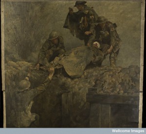 L0050213 World War I: stretcher bearers of the Royal Army Medical Credit: Wellcome Library, London. Wellcome Images images@wellcome.ac.uk http://wellcomeimages.org World War I: stretcher bearers of the Royal Army Medical Corps (RAMC) lifting a wounded man out of a trench. Painting by Gilbert Rogers. Below, a trench in which a man stands lifting one end of a stretcher over the top of the trench. Above, three man receive the stretcher, on which lies a man with his face covered with a bloody bandage. Left, a shell explodes. The background is buff, the trench and the figures are predominantly grey, yellow and green, giving an impression of mud everywhere.  Of the men in the upper half, two have armbands with red crosses on a white ground, in addition to uniform badges with red crosses on, while the third, on the left, has only the red cross badge on his uniform, and no armband.  The body of the man on the stretcher is foreshortened to show the soles of his boots, a device also found in paintings by Mantegna, Borgianni, and Rembrandt. 1919 By: Gilbert RogersPublished:  -  Copyrighted work available under Creative Commons Attribution only licence CC BY 4.0 http://creativecommons.org/licenses/by/4.0/