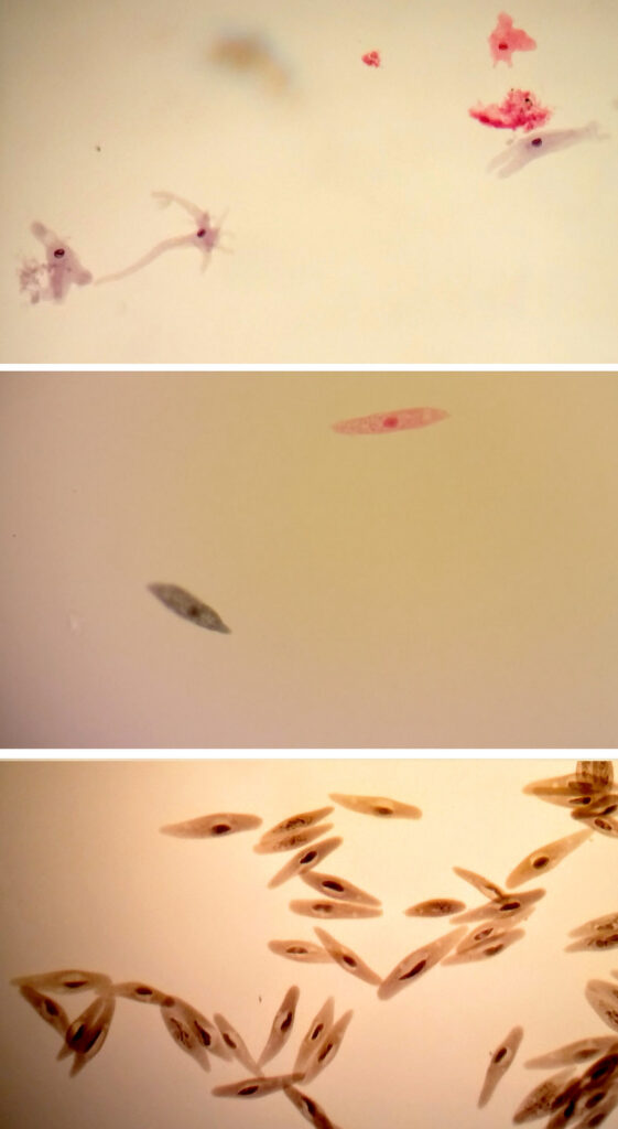 Three types of protozoa