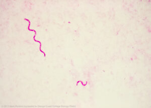 A microscope view of a pink bacteria