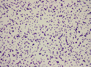 A close-up of purple bacteria on a white background