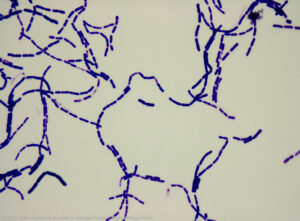 A close-up of purple bacteria on a white background