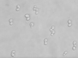 translucent oval shaped cells of different sizes, some clustered together on a gray background 