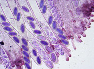 Translucent elongated sac-like structures containing purple oval shapes
