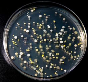 A petri dish with white and yellow dots of various sizes