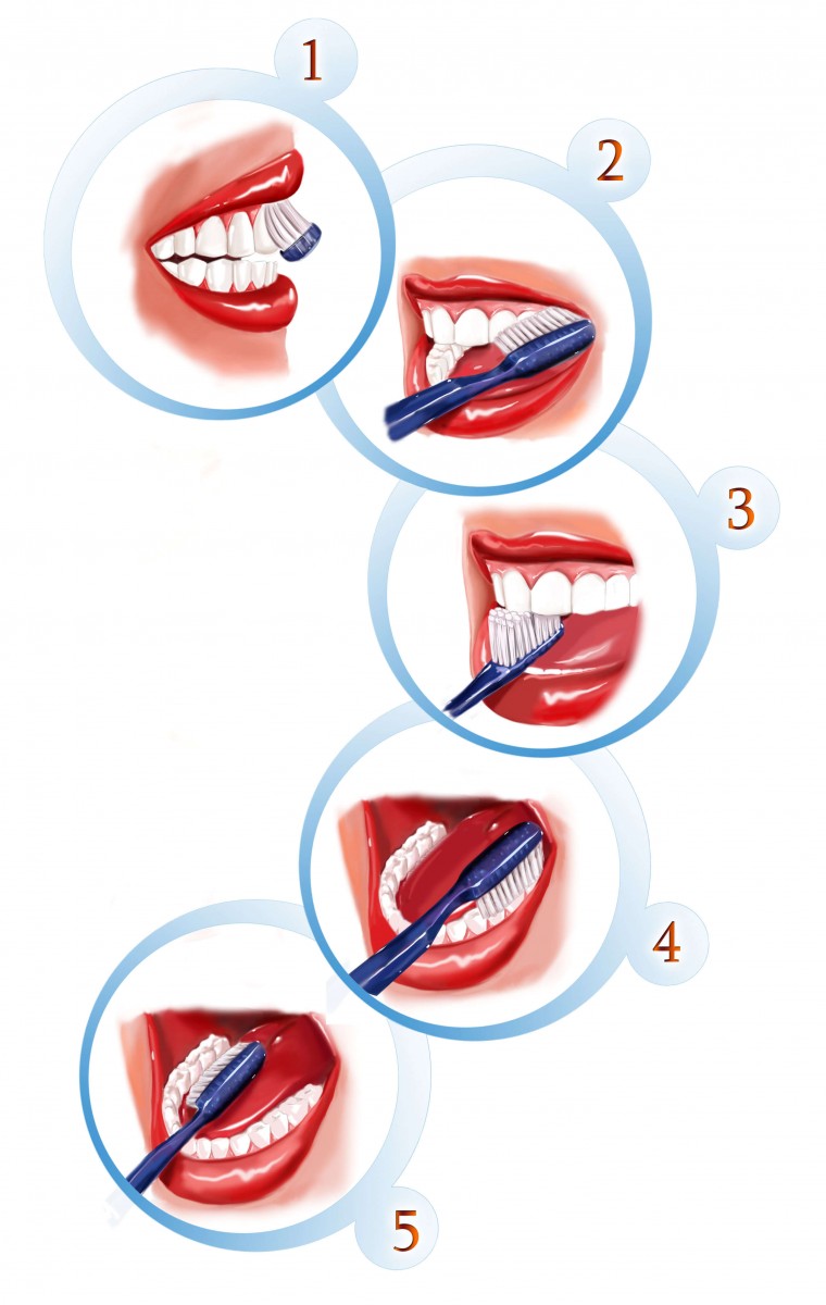 Steps In Brushing Teeth