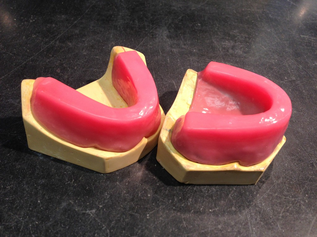 occlusal rims | Paulina Zarlok's ePortfolio