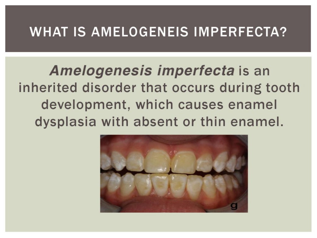 amelogenesis imperfecta eportfolio-page-002