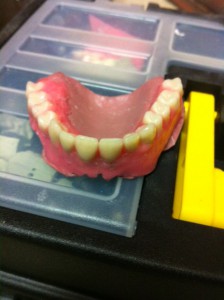 Setting up of Maxillary teeth.